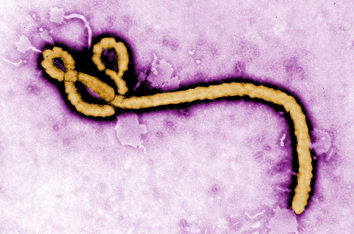  20221021 On Ebolavirus