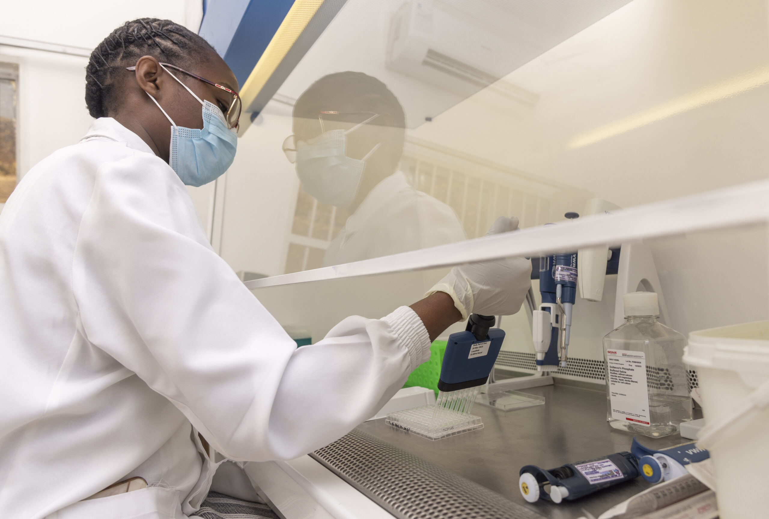 Chibale Mwelwa Testing Samples At The Cfhr Laboratory In Lusaka Zambia On 17th August 2022