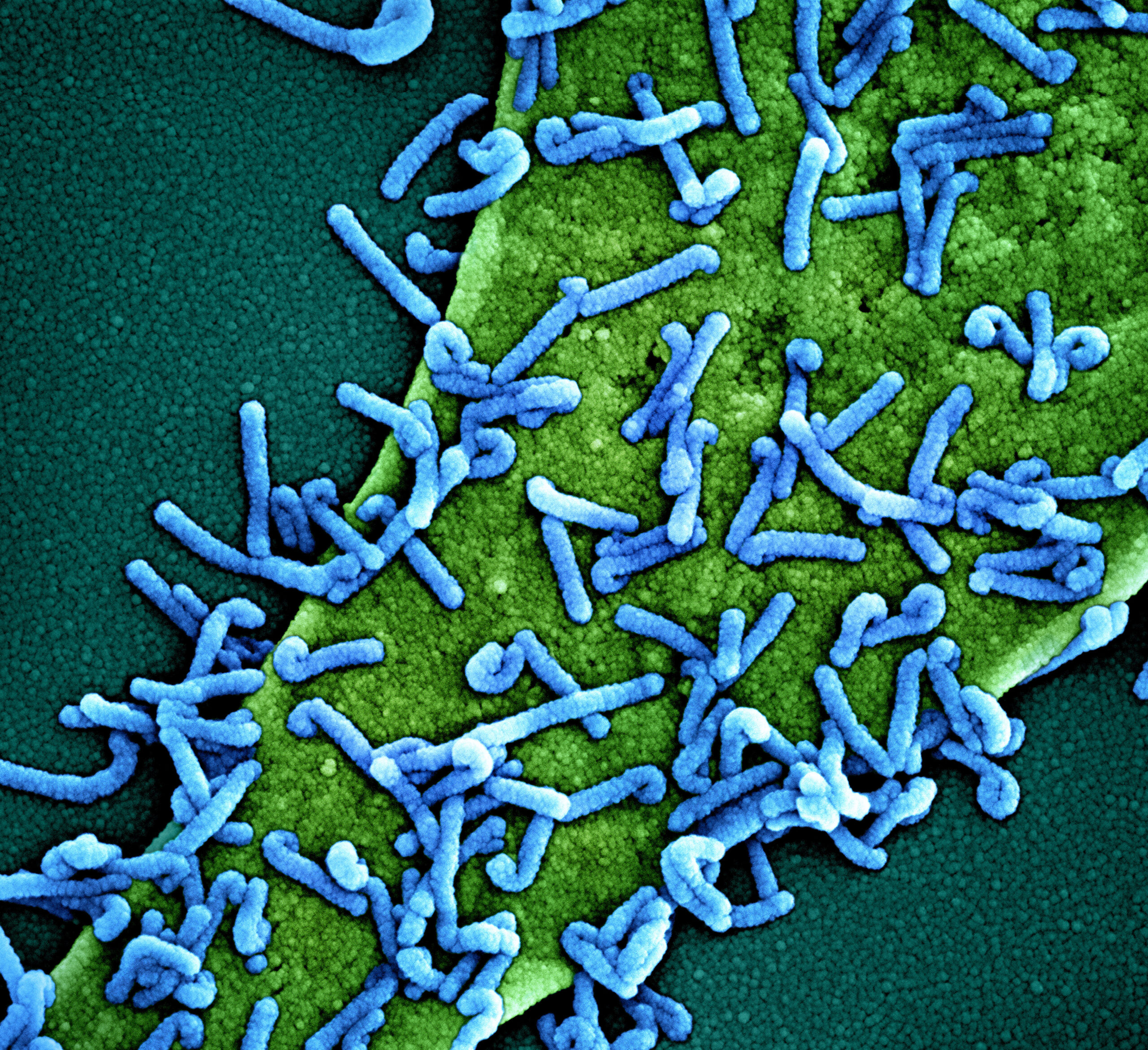 Colorized scanning electron micrograph of Marburg virus particles (blue) both budding and attached to the surface of an infected VERO E6 cell (green). Image captured at the NIAID Integrated Research Facility in Fort Detrick, Maryland. Credit: NIAID