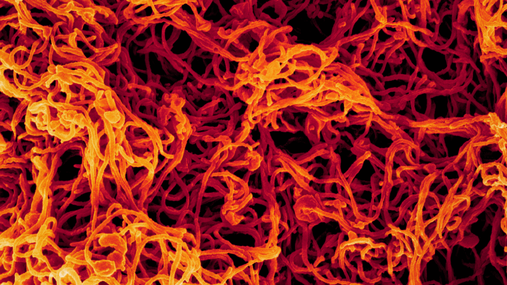 Ebola virus