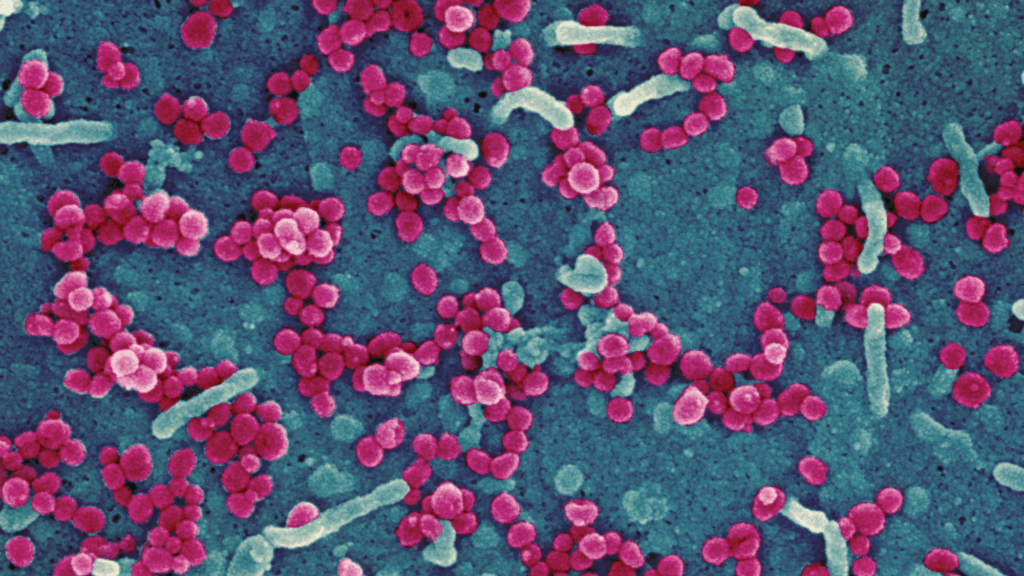 Scanning electron micrograph of Lassa virus budding off a cell