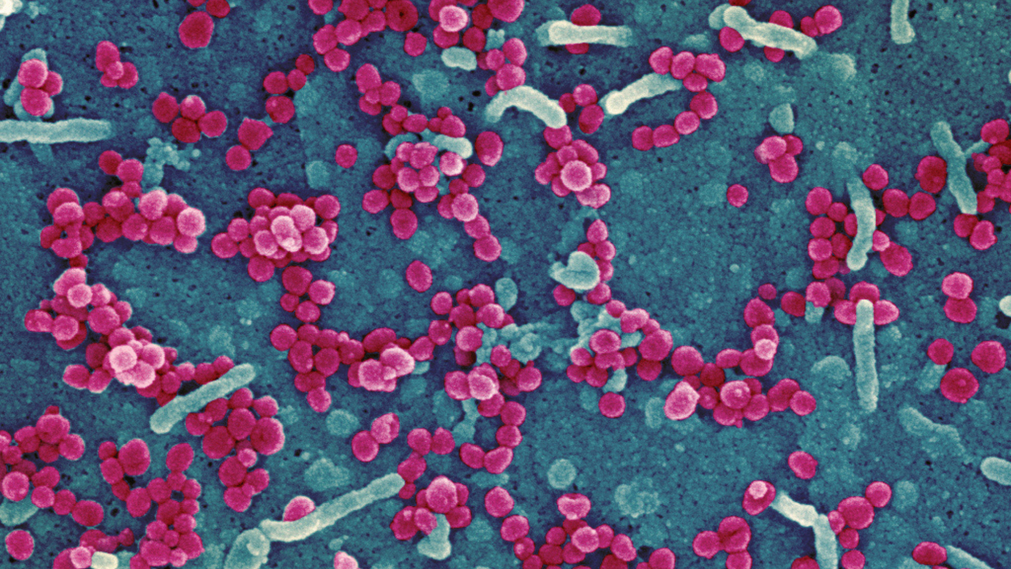 Scanning electron micrograph of Lassa virus budding off a cell. Credit: NIAID