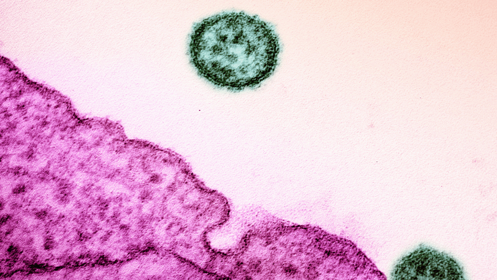 Colorized transmission electron micrograph of two mature extracellular Lassa virus particles (teal) near the periphery of a VERO E6 cell (pink).