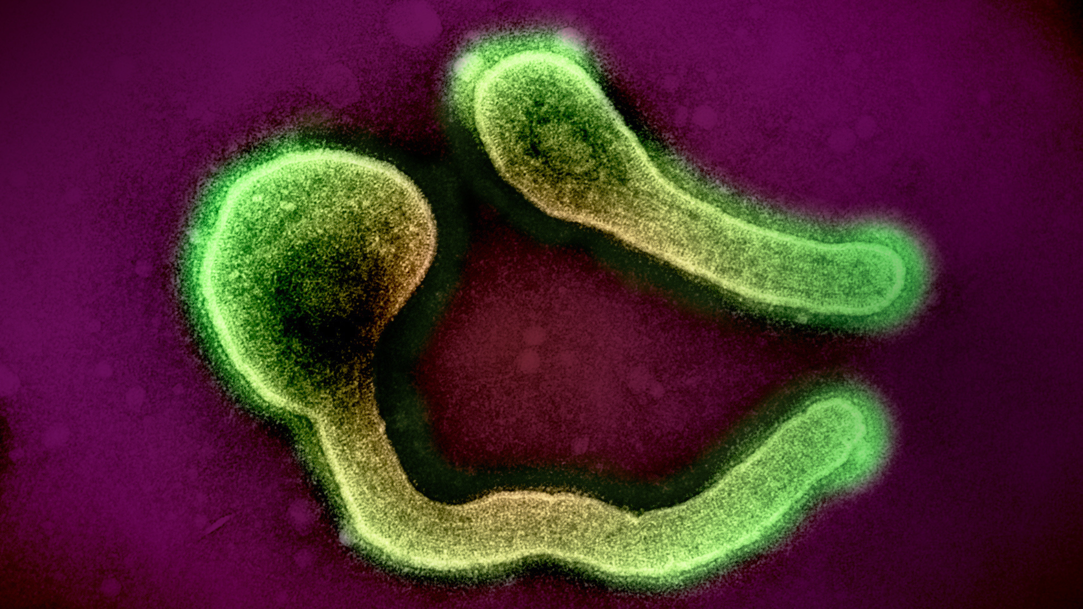 Colorized transmission electron micrograph of two Marburg Virus particles (green) harvested from infected VERO E6 cell supernatant. Credit: NIAID