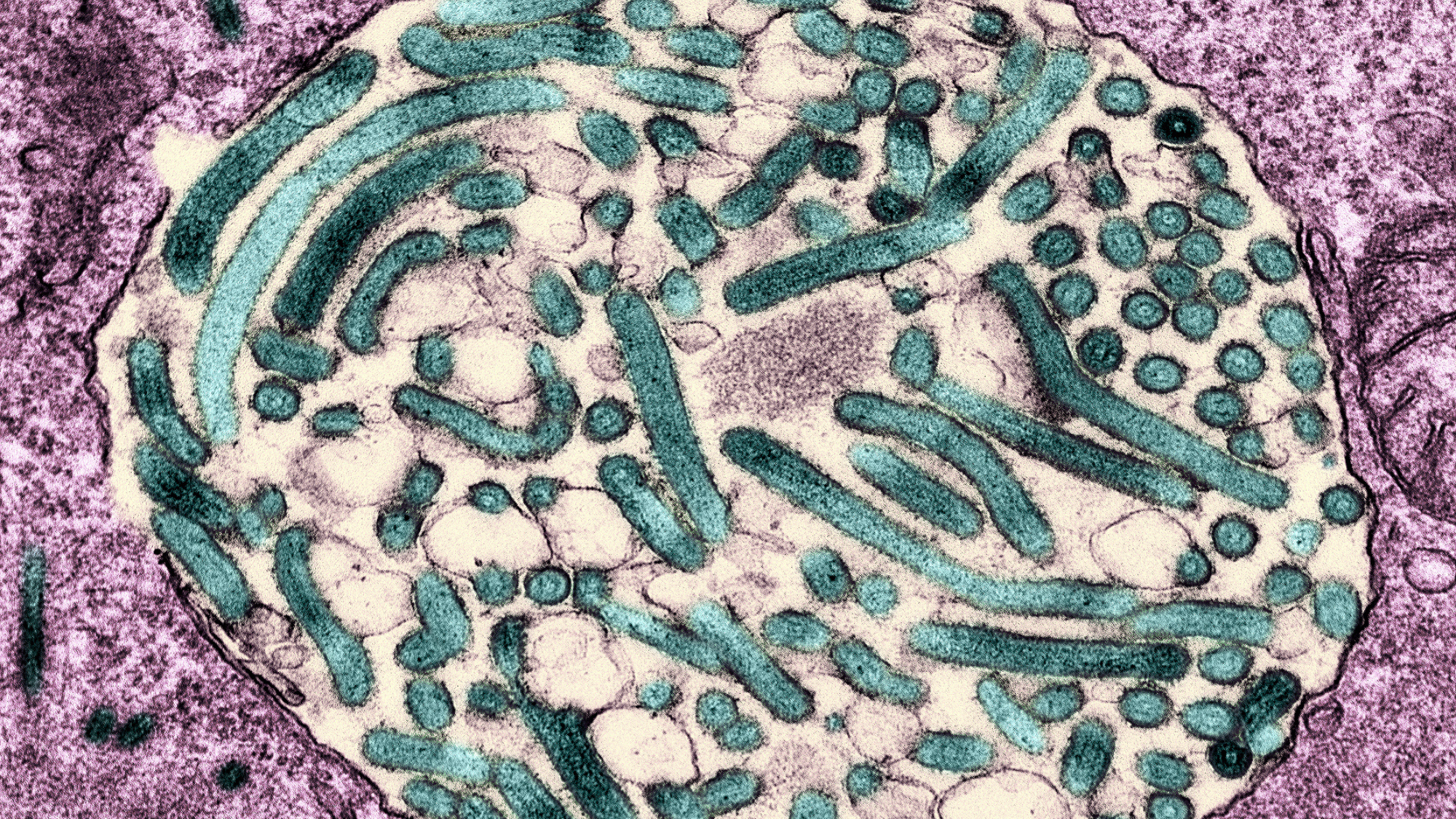 Colorized transmission electron micrograph of mature Marburg virus particles (teal) within a cytoplasmic vacuole (center area; tan) in an infected VERO E6 cell. Credit: NIAID
