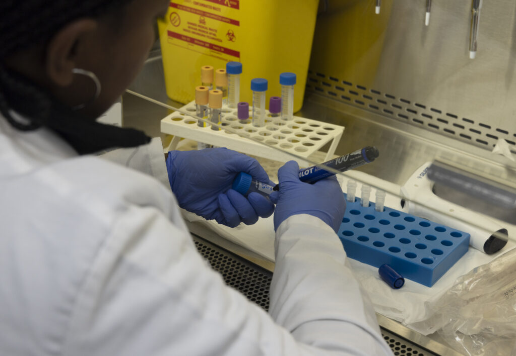 Labelling samples at Aurum Institute Rustenberg, South Africa on 23rd August 2022.