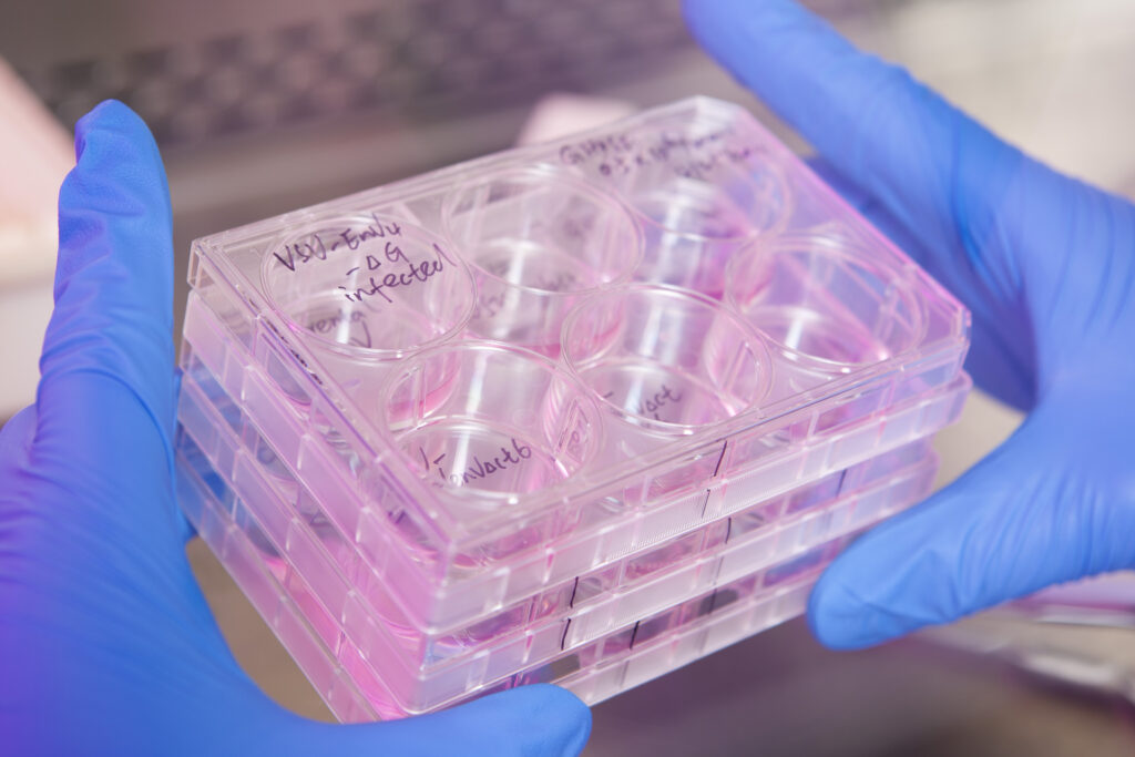 The Iavi Design And Development Lab (ddl) Is The Hub Of Iavi Research And Development In The Quest For An Aids Vaccine. The Ddl Is The Only Laboratory In The World Exclusively Focused On Aids Vaccine Research. The Ddl Meets The Highest Industry Standard