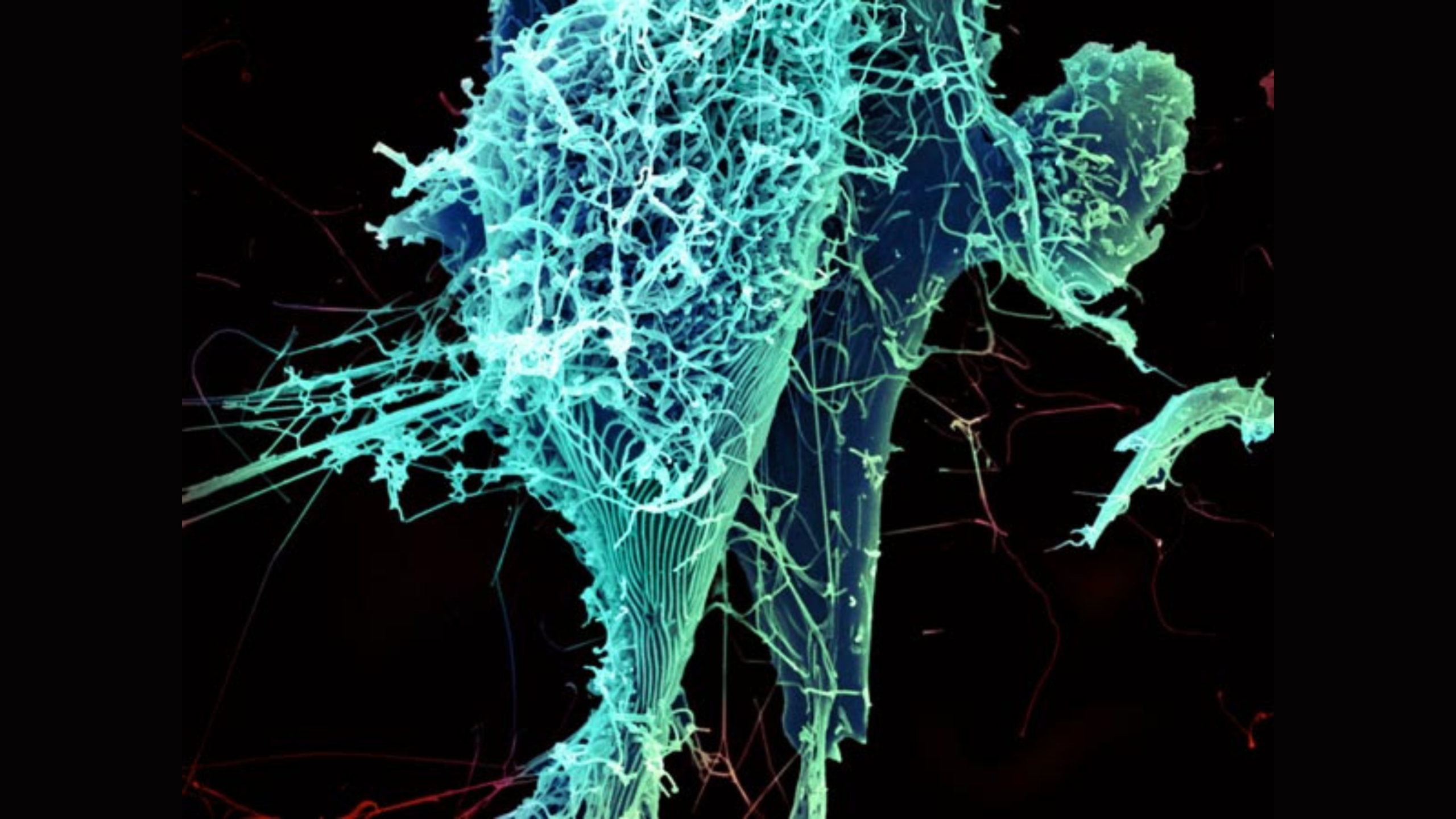 Credit: Heinz Feldmann, Peter Jahrling, Elizabeth Fischer and Anita Mora, National Institute of Allergy and Infectious Diseases/NIH