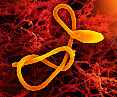 Ebola virus IAVI C108 homepage