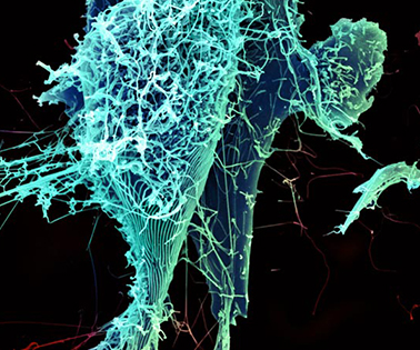 String-like Ebola virus peeling off an infected cell