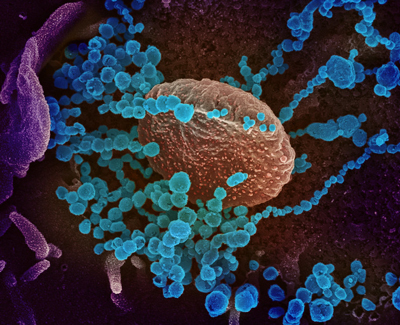 Novel Coronavirus SARS CoV 2