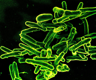 TB bacteria homepage